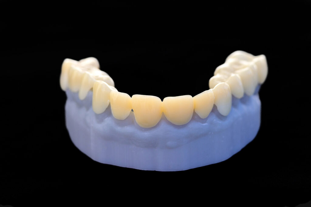 3D Printing for Dentistry 2025: Market Study & Forecast