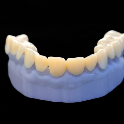 3D Printing for Dentistry 2025: Market Study & Forecast