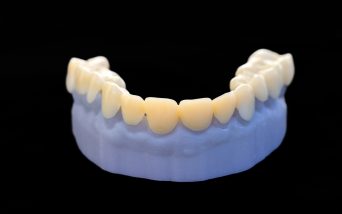 3D Printing for Dentistry 2025: Market Study & Forecast